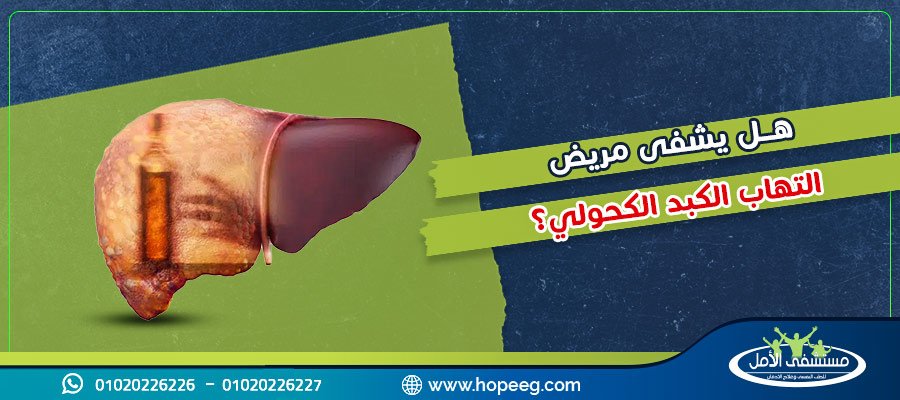 التهاب الكبد الكحولي