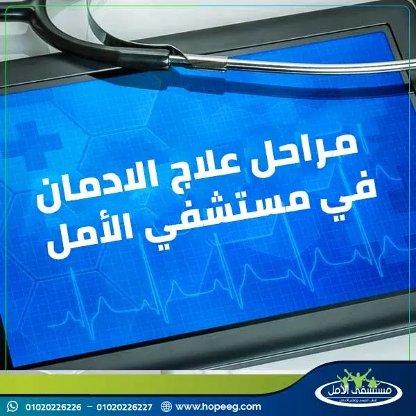 مراحل علاج الادمان في مستشفى الامل