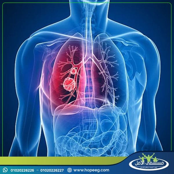 ما هي مضاعفات تناول التمباك؟