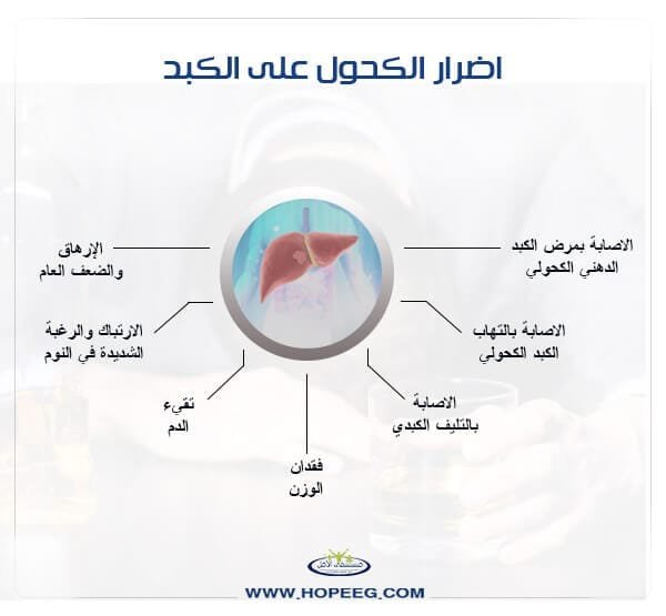 اضرار-الكحول-ع-الكبد