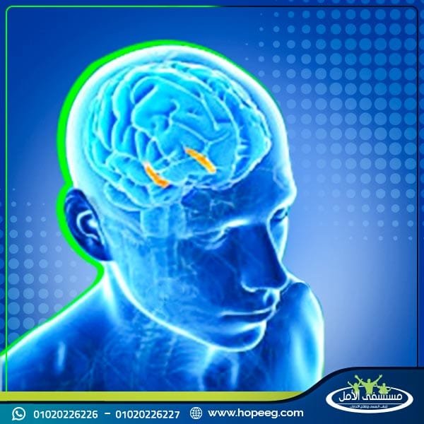 الاكتئاب الذهاني