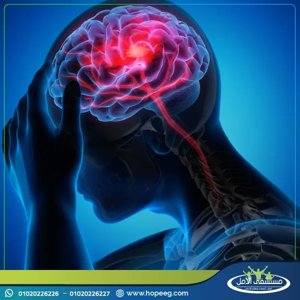 ما هي تأثيرات ليريكا على المخ والأعصاب ؟