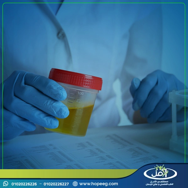 مدة بقاء الحشيش في البول لغير مدمن