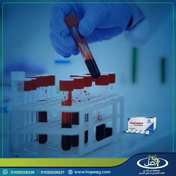 مدة خروج الترامادول من الجسم وتنظيفه نهائياً
